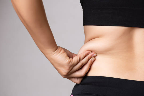 Everything you Need to Know about Liposuction